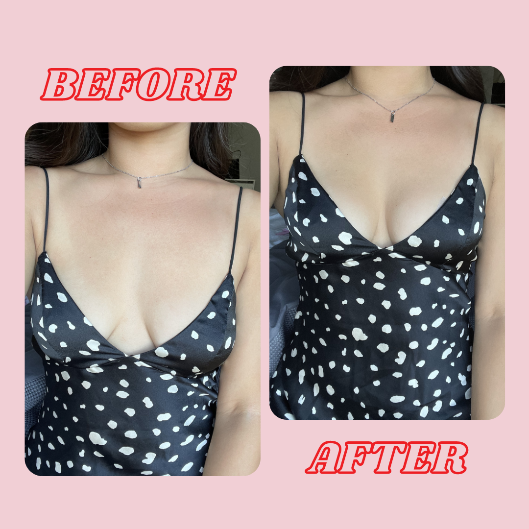 Is boob tape good for saggy breasts?